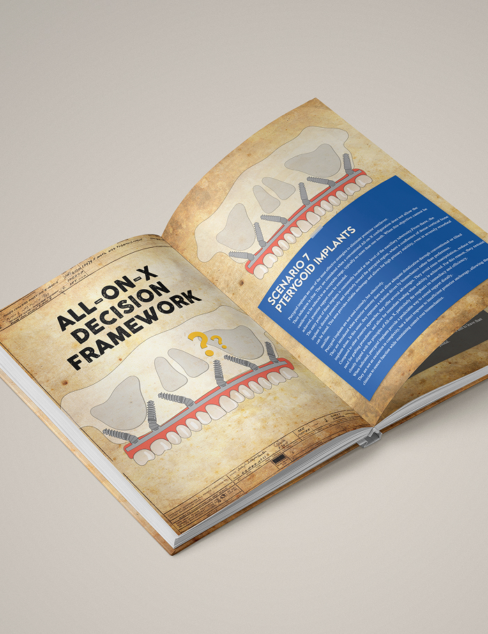 Volume 1 - Full-Arch Rehabilitation: Atrophic Maxilla & Mandible - Image 5