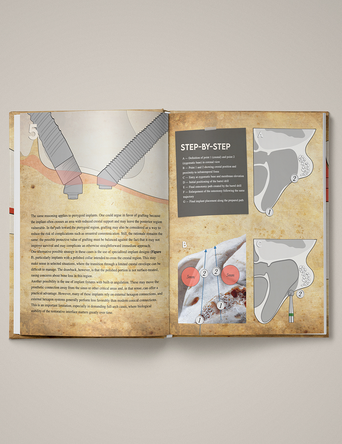 Volume 1 - Full-Arch Rehabilitation: Atrophic Maxilla & Mandible - Image 3